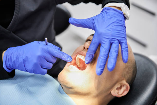 Best Emergency Care for Gum Disease in USA